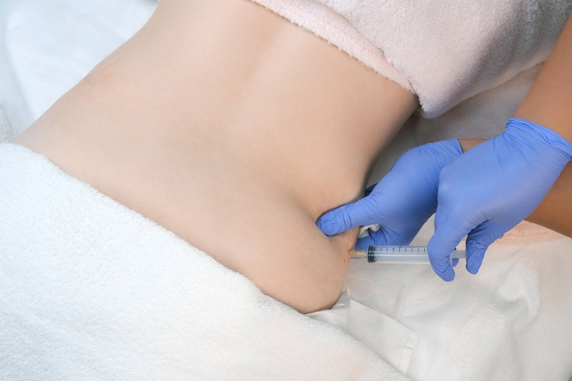 Ozontherapie
